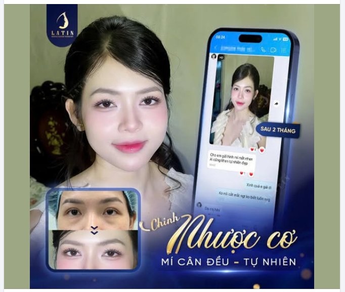 GIẢI CỨU MÍ CŨ LỖI - "BẮT TREND" MẮT PHƯỢNG HOÀNG BAY BỔNG
