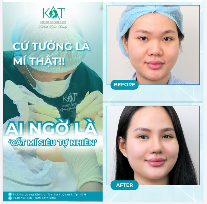 CỨ TƯỞNG LÀ MÍ THẬT – AI NGỜ LÀ “CẮT MÍ SIÊU TỰ NHIÊN”