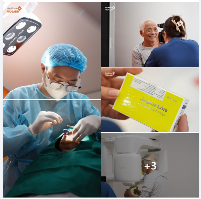 TRAO NIỀM TIN ĐÚNG NƠI – HÀNH TRÌNH PHỤC HỒI RĂNG MẤT TRỞ NÊN NHẸ NHÀNG HƠN BAO GIỜ HẾT