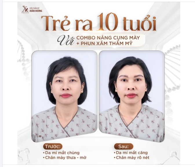 HÌNH ẢNH ĐẦU TIÊN SAU KHI KHÁCH HÀNG THỰC HIỆN PHUN XĂM + NÂNG CUNG MÀY TẠI VTM XUÂN HƯƠNG