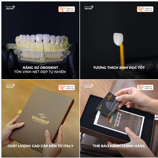RĂNG SỨ ORODENT CAO CẤP KIẾN TẠO NỤ CƯỜI ĐẲNG CẤP