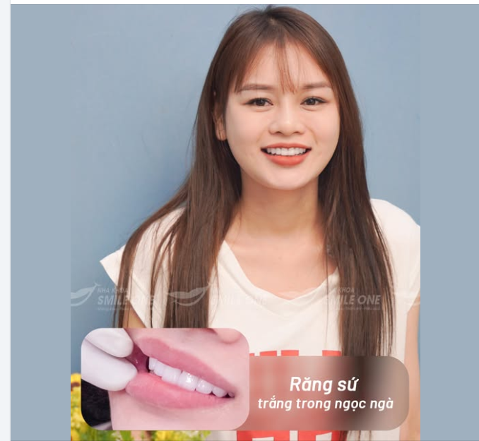 Độ bóng và trong của răng sứ được tạo ra thế nào?