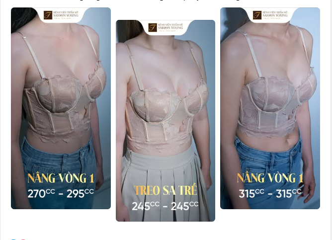 Có thể “đặt size túi giống bạn bè” vì mong kết quả y hệt không?