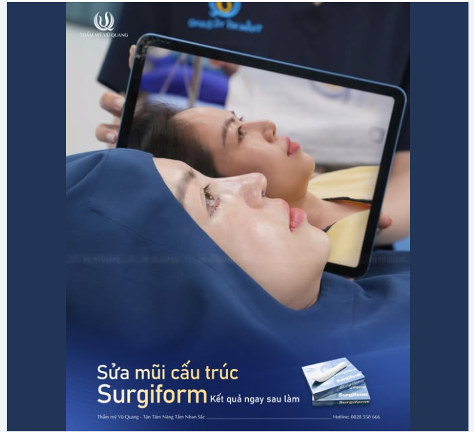 Biến hình sau sửa mũi của MC Hiền Cua