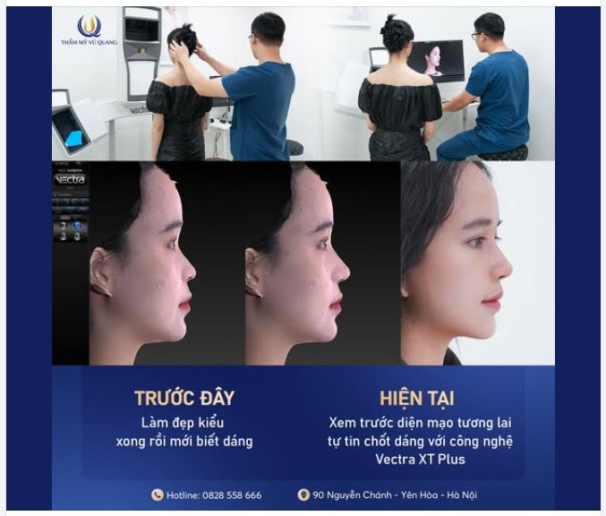 VECTRA XT PLUS – "CỖ MÁY THẦN KỲ" NHÌN TRƯỚC DIỆN MẠO TƯƠNG LAI