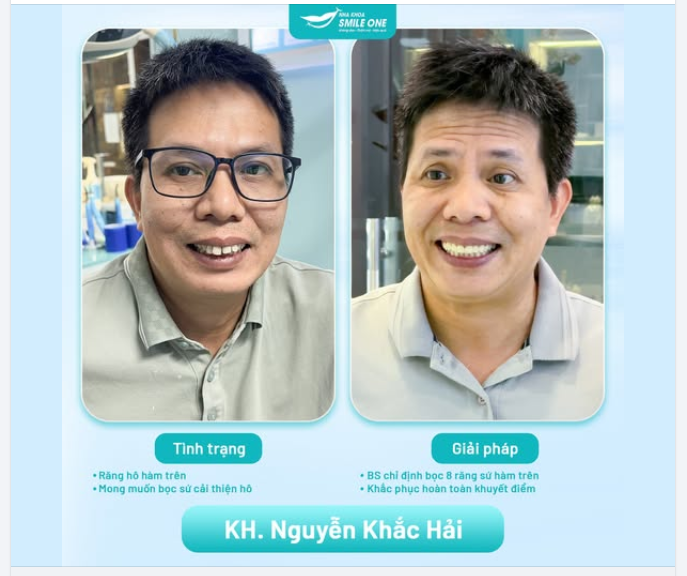 Làm răng sứ không chỉ dành cho mỗi phái đẹp.