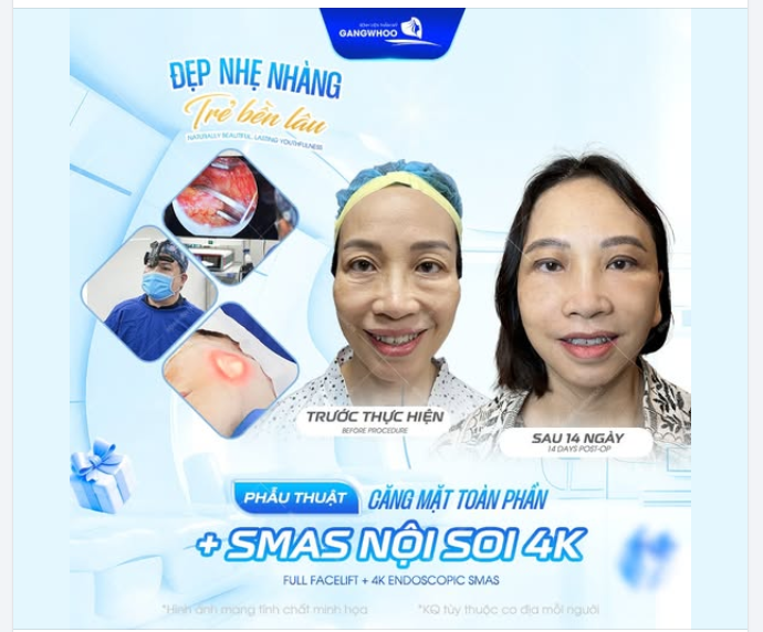 ​​​​​​​Trẻ đẹp hơn – Tự tin hơn – Một lần thực hiện, kết quả dài lâu. Inbox ngay đến Bệnh viện thẩm mỹ Gangwhoo nhé!