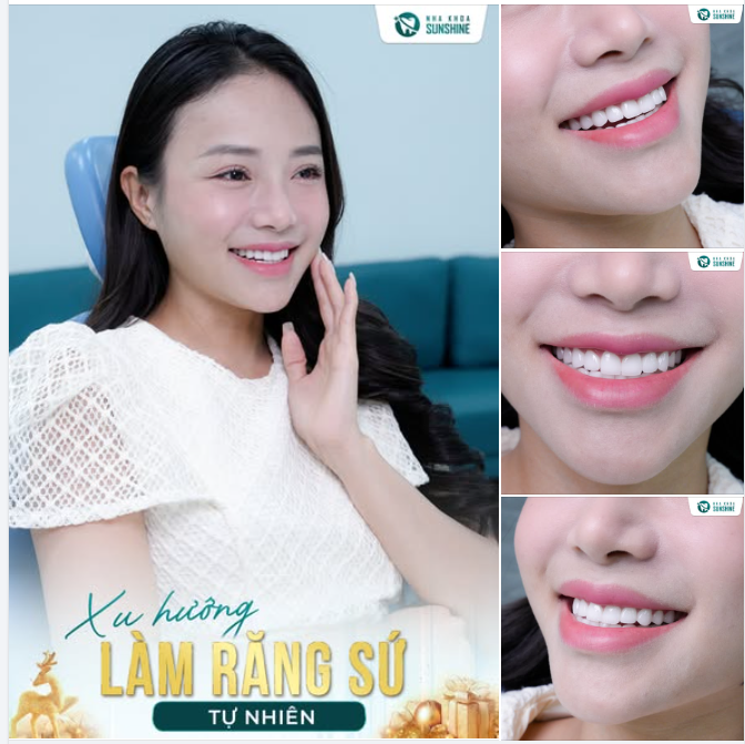 Có những nụ cười nhìn rất cuốn… nhưng không ai đoán ra đã làm răng sứ.