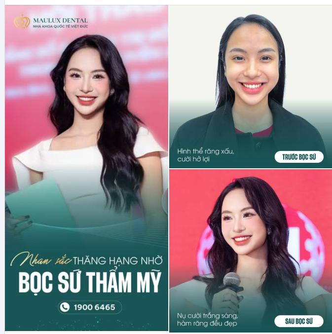 BÍ MẬT NỤ CƯỜI RẠNG RỠ CỦA MC THANH TÚ