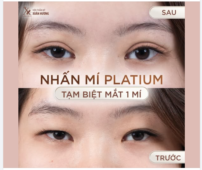 TẠI SAO NHẤN MÍ LUÔN LÀ LỰA CHỌN HÀNG ĐẦU CỦA CHỊ EM?