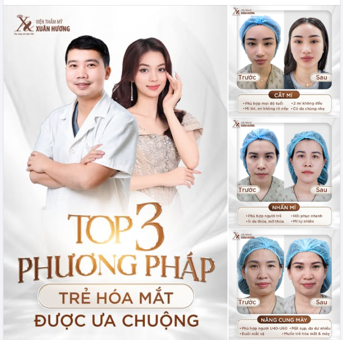 TOP 3 PHƯƠNG PHÁP TRẺ HÓA MẮT ĐƯỢC CHỊ EM ƯA CHUỘNG NHẤT DỊP CUỐI NĂM
