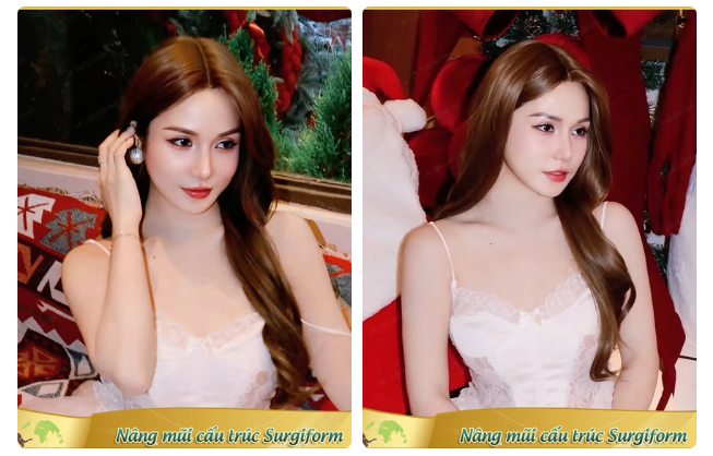 Mũi cấu trúc Barbie-line bước sang năm tuổi thứ 7 vẫn bền đẹp như ngày đầu!