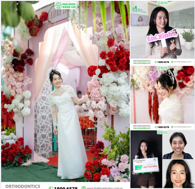 “She said YES ” - Yes với anh ấy, và Yes với… niềng răng