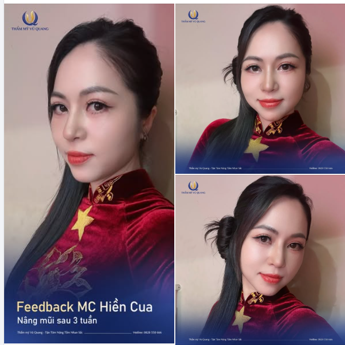 MC Hiền Cua chiếm trọn sportlight trong tà áo dài truyền thống của Việt Nam.