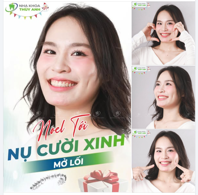 NOEL TỚI – NỤ CƯỜI XINH MỞ LỐI