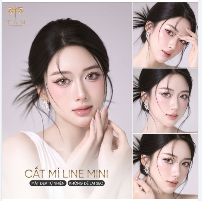 "CẮT MÍ XONG CÓ BỊ LỘ KHÔNG EM?"