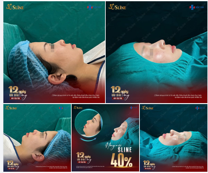 HÔM NAY LÀ CUỐI CÙNG – BỎ LÀ MẤT 40%