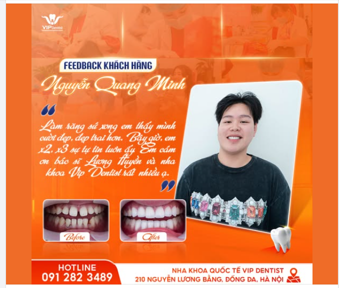 GƯƠNG MẶT BỪNG SÁNG, TỰ TIN “LEVEL UP” SAU KHI LÀM RĂNG SỨ TẠI VIP DENTIST