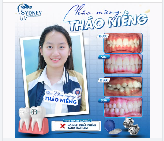 CHÚC MỪNG THÁO NIỀNG KH.PHƯƠNG DUNG