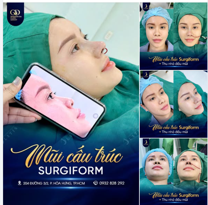 MŨI KHÔNG CẦN QUÁ CAO, CHỈ CẦN HÀI HÒA VÀ SANG TRỌNG