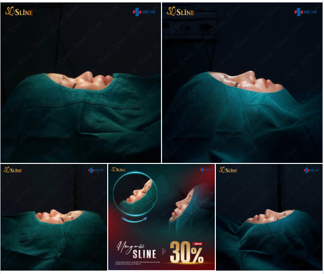 TRƯỚC – SAU KHÁC BIỆT, NHÌN LÀ HIỂU