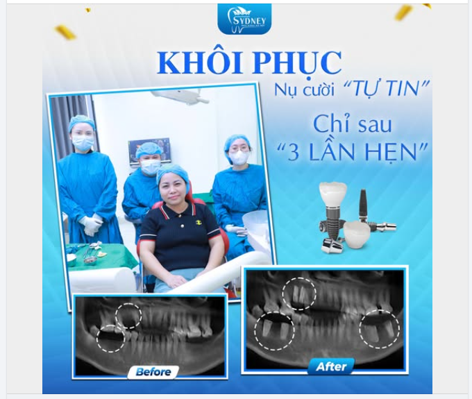 KHÔI PHỤC NỤ CƯỜI TỰ TIN CHỈ SAU 3 LẦN HẸN