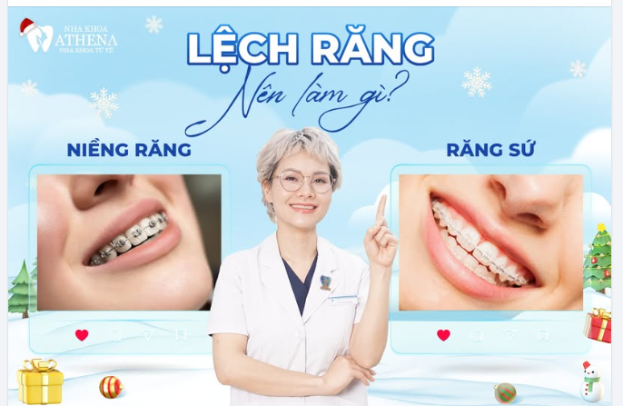 RĂNG LỆCH NHẸ  CHUYÊN GIA BẬT MÍ NÊN CHỌN BỌC SỨ HAY NIỀNG RĂNG