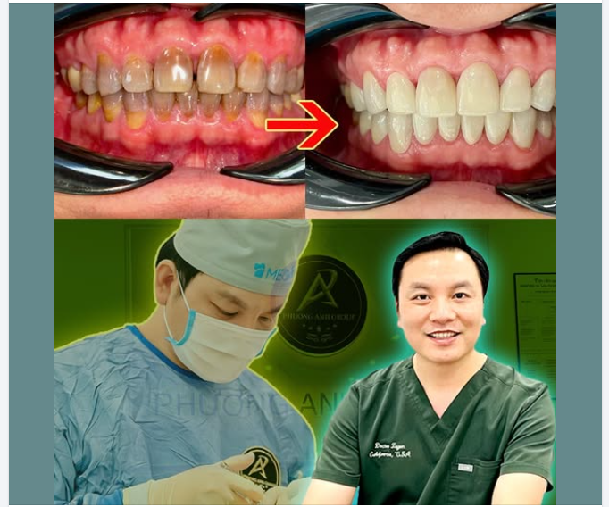 Cách chăm sóc răng miệng đúng cách, hiệu quả răng khỏe