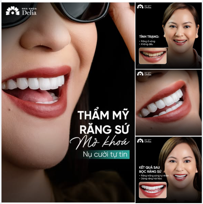 Làm răng sứ tại Delia – Mở khoá nụ cười tự tin  Trước khi đến với Delia, khách hàng gặp phải: