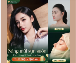 NÂNG MŨI SỤN SƯỜN - BÍ QUYẾT NÂNG HẠNG THẦN THÁI CỦA HOA HẬU YẾN NHI!!