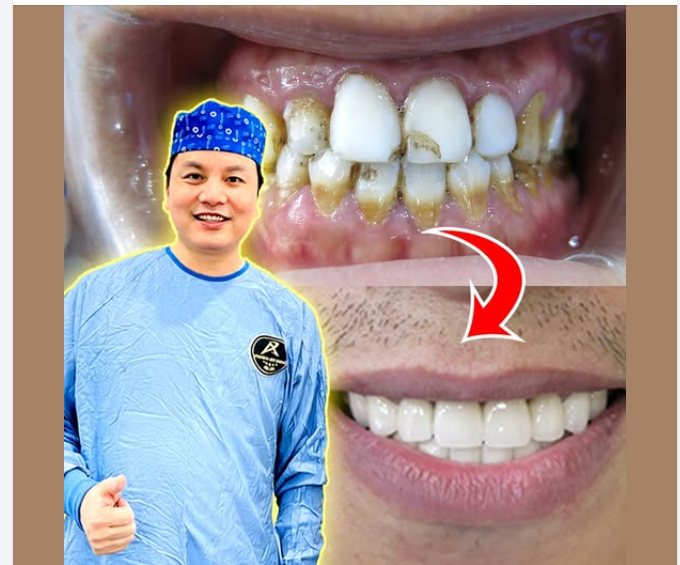 ừ răng ố vàng, mảng bám nhiều nụ cười trắng sáng – đều đẹp – tự tin hơn mỗi ngày