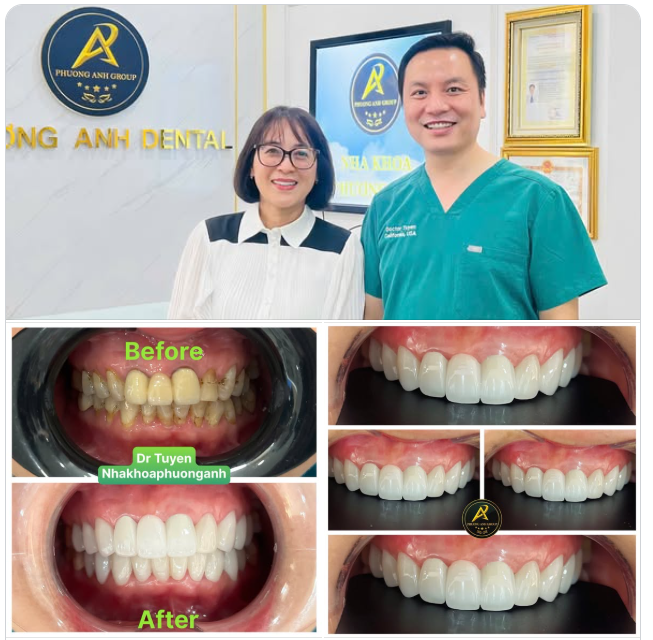 Tái tạo nụ cười tỏa sáng cho chị đẹp đón Tết!