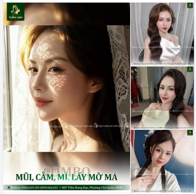 NÂNG MŨI + CẮT MÍ + ĐỘN CẰM + LẤY MỠ MÁ COMBO XINH ĐẸP NHÀ TUẤN LINH!