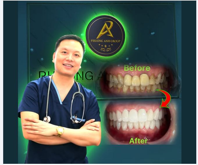 Nụ cười mới – diện mạo mới