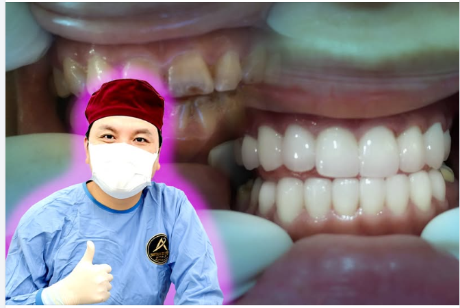 Kết quả hôm nay là sự cố gắng của cả bác sĩ lẫn khách hàng.