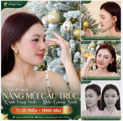 Người đẹp Quách Thanh Thư - Miss Grand Cà Mau 2025 check-in Giáng Sinh tại Saigon Star với visual rạng rỡ, dáng mũi mới hài hòa và tự nhiên sau 10 ngày NÂNG MŨI CẤU TRÚC khiến ai nhìn cũng mê