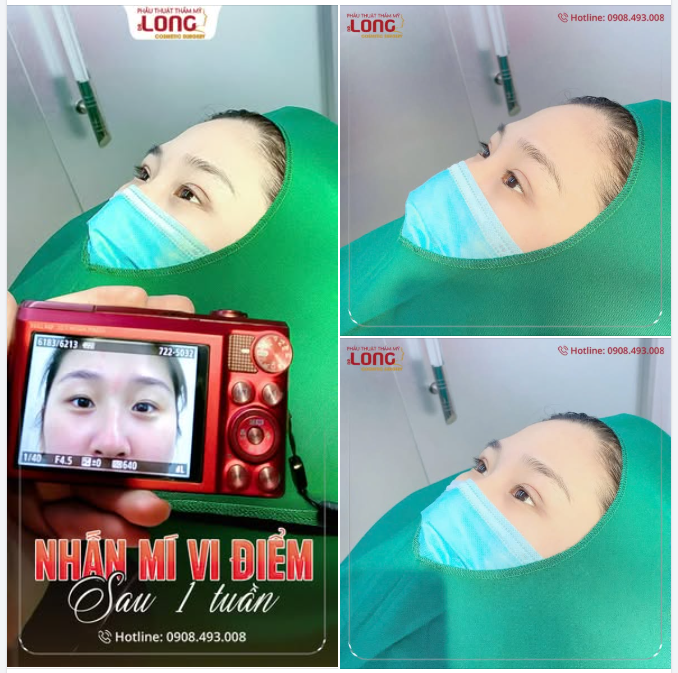 CUỐI NĂM MUỐN ĐẸP NHANH NHƯNG NGẠI PHẪU THUẬT