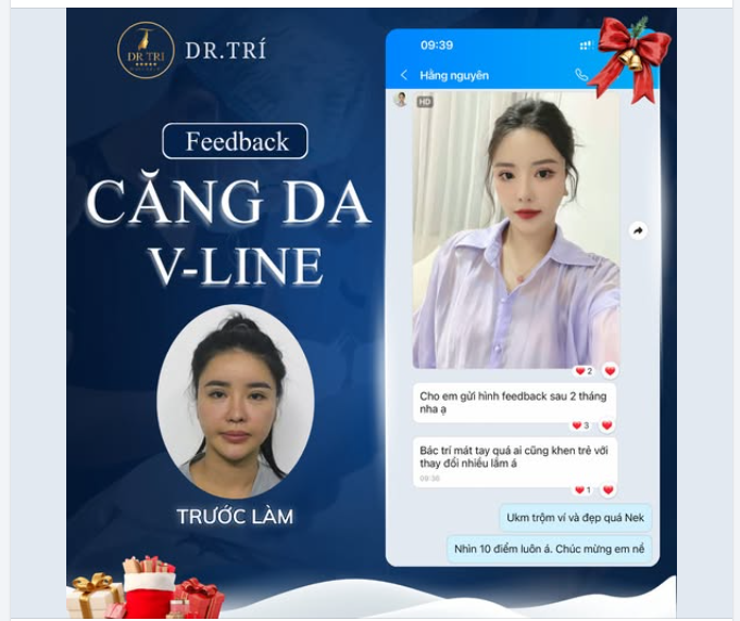 CĂNG DA V-LINE: TẠM BIỆT NỖI LO CHẢY XỆ - LẤY LẠI 10 NĂM TUỔI XUÂN!