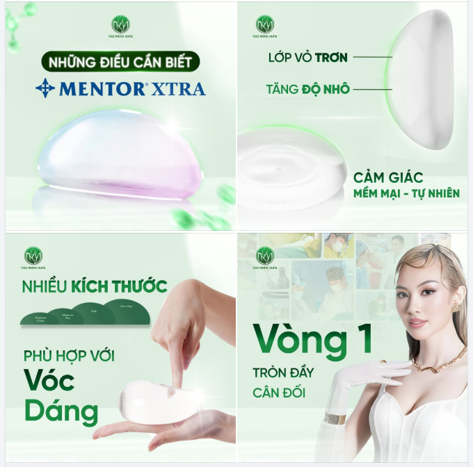 Những điều cần biết Mentor Xtra