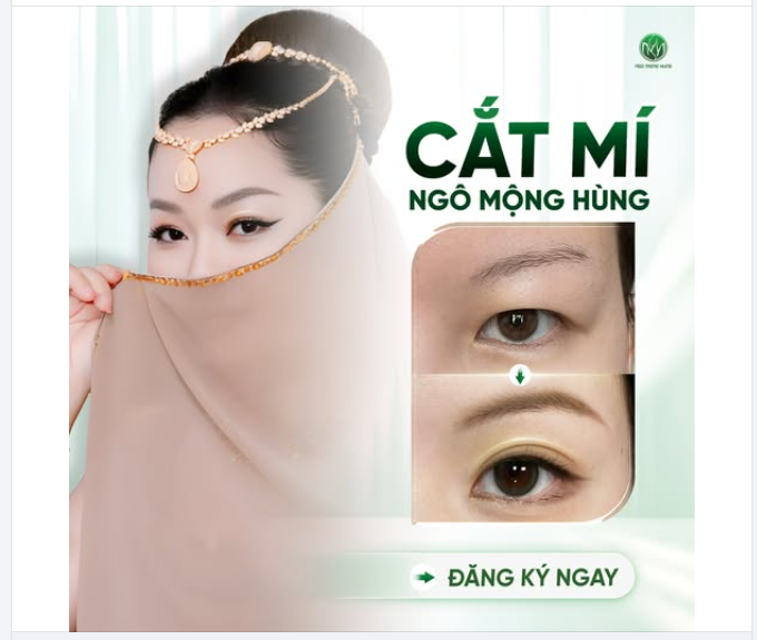 Mắt đẹp, mí sang tôn nét thanh tao, quý phái  Thẩm mỹ mắt - Ưu đãi lên đến 50%