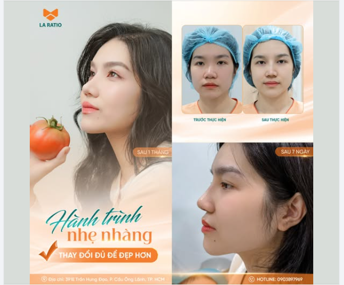 HÀNH TRÌNH NHẸ NHÀNG – THAY ĐỔI ĐỦ ĐỂ ĐẸP HƠN