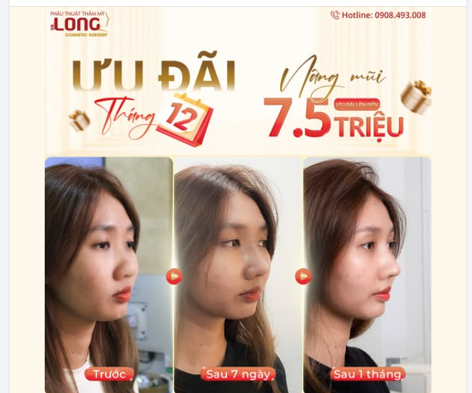 HÀNH TRÌNH NHẸ NHÀNG GIÚP NÀNG XINH ĐẸP