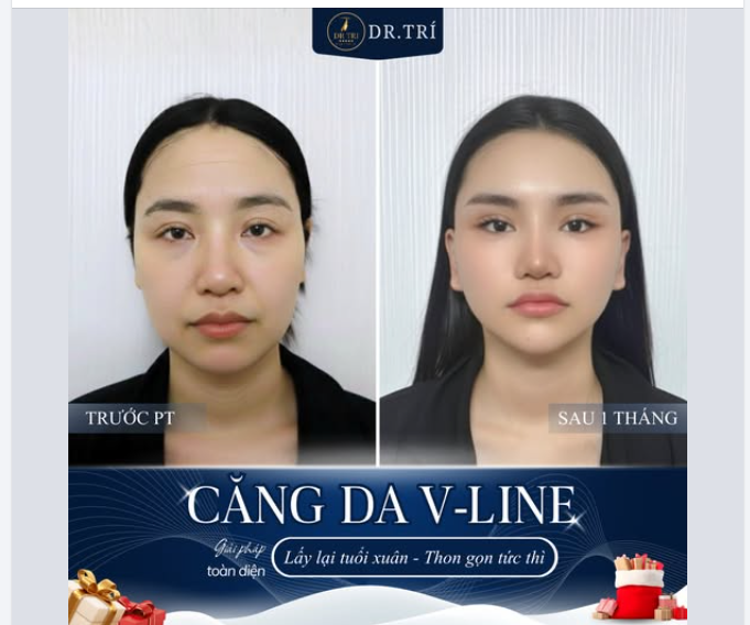 SỢ LÃO HÓA CHẢY XỆ – KHAO KHÁT GƯƠNG MẶT V-LINE THANH TÚ