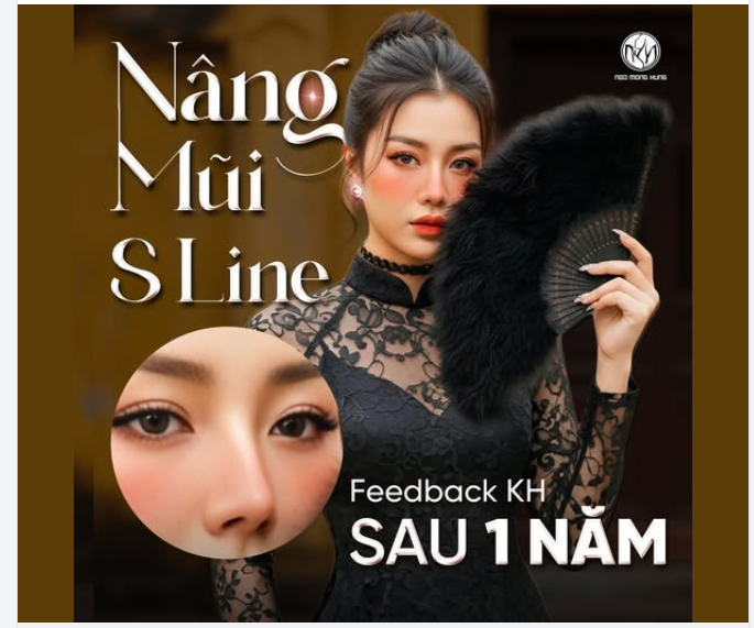 Nàng nào thắc mắc sau nâng mũi S-line sẽ như thế nào? Thì chiêm ngưỡng hình feedback dưới đây nhé.
