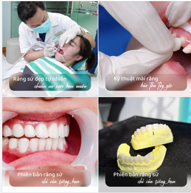 Mỗi hàm răng sứ "ra đời", là một tác phẩm được điêu khắc bởi bàn tay tài hoa của người bác sĩ tại Smile One!