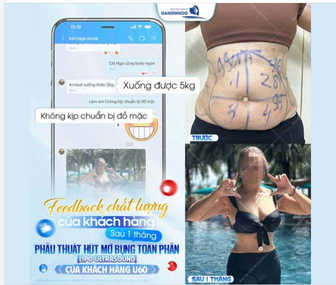 FEEDBACK CHẤT LƯỢNG CỦA KHÁCH BVTM GANGWHOO