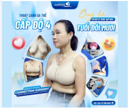 THOÁT CẢNH SA TRỄ CẤP ĐỘ 4 – QUÝ BÀ LẠI TRẺ TRUNG NHƯ TUỔI 20
