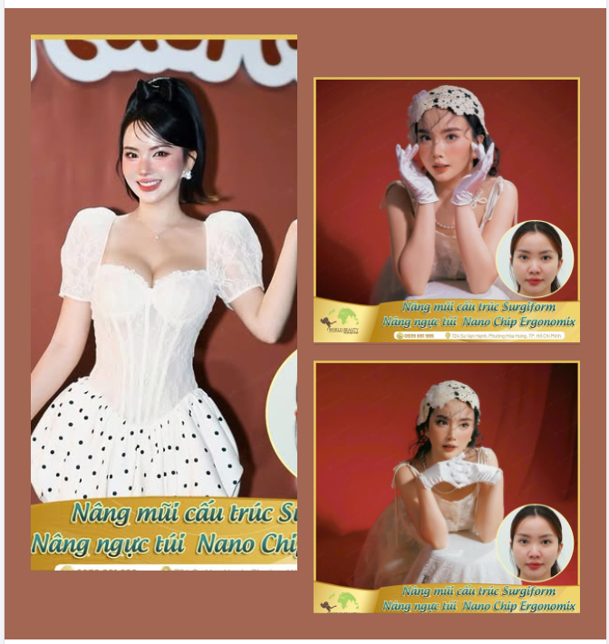 Nhìn lại sau 5 năm với kết quả mũi và Vòng 1 hoàn hảo, bền lâu theo thời gian