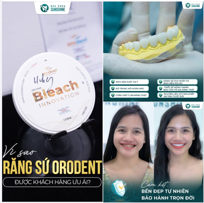 Không phải ngẫu nhiên ORODENT được nhiều khách hàng ưu ái và được lựa chọn cho những ca yêu cầu độ tinh xảo tuyệt đối