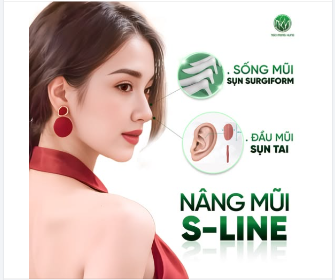 Nâng mũi S-line - Giảm đến 15TR